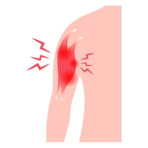 Prevent Muscle Loss